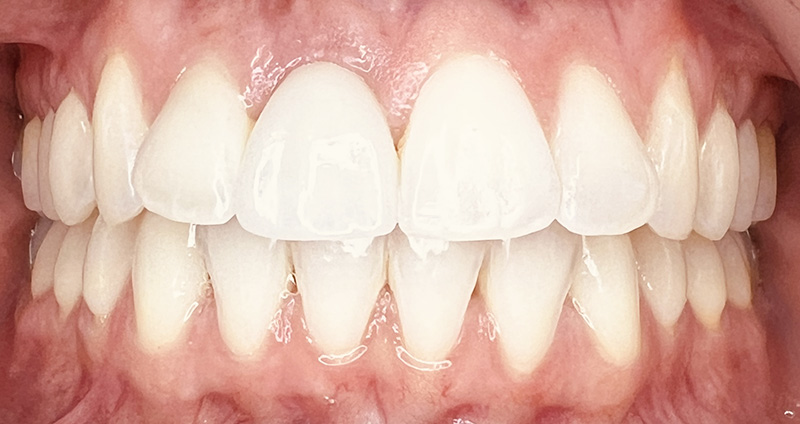 After Image