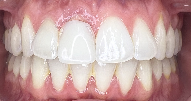 Before Image