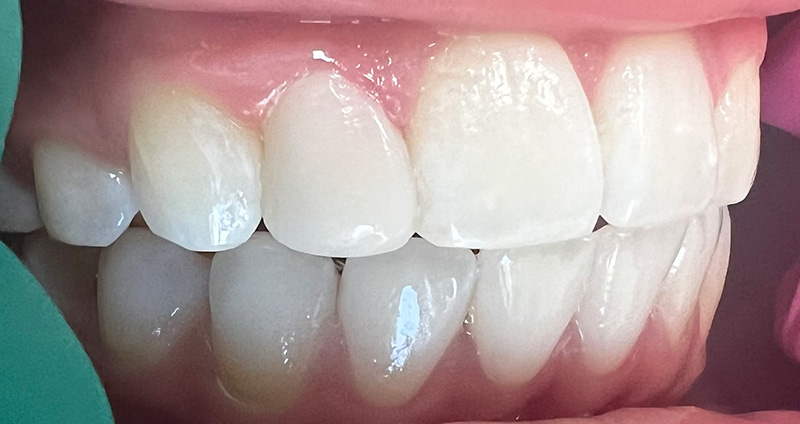 After Image