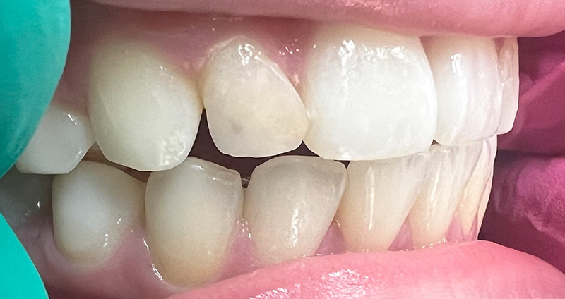 Before Image