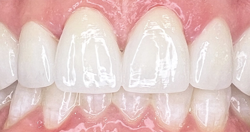 After Image
