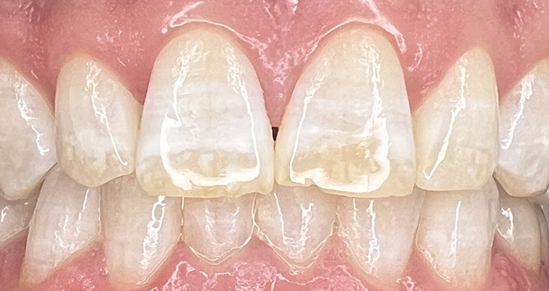 Before Image