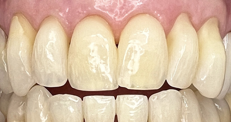 Before Image