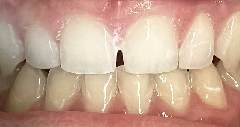 Before Image