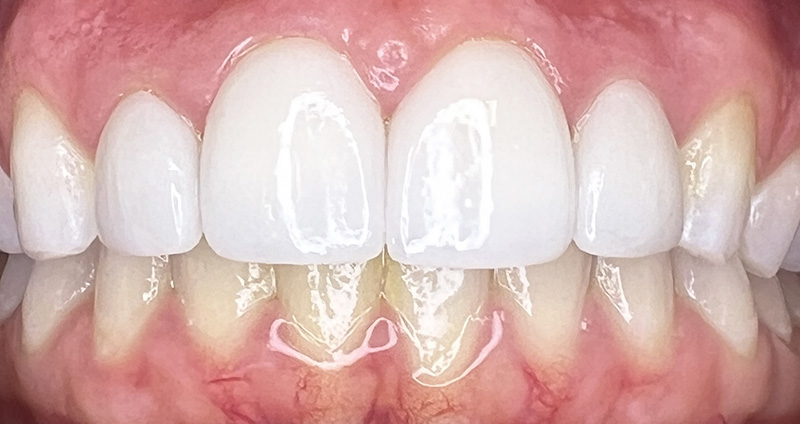 After Image