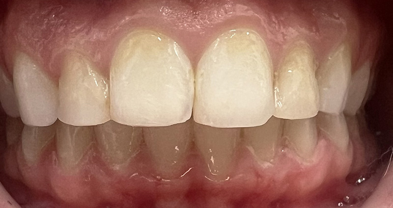 Before Image