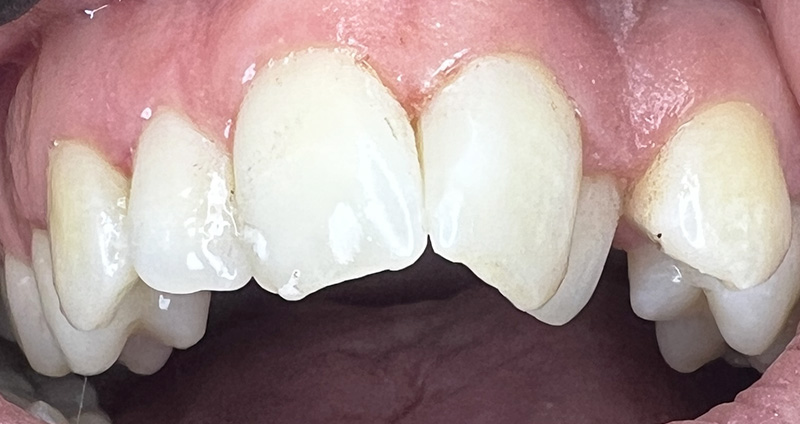 After Image