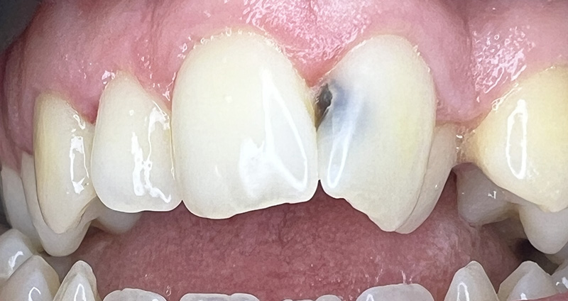 Before Image