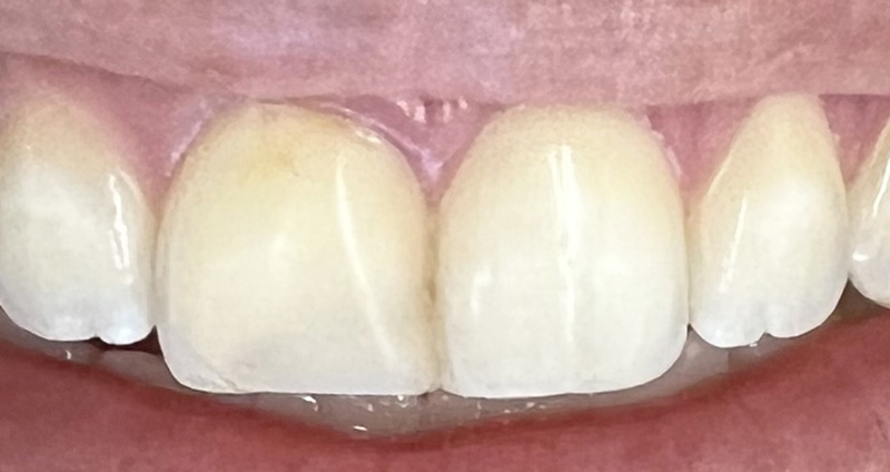 After Image