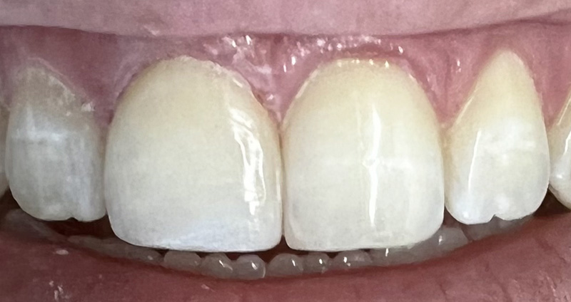 Before Image