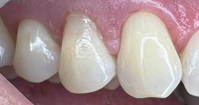 After Image