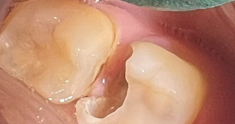 Before Image