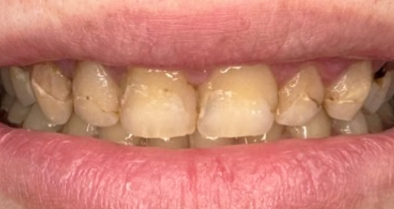 Before Image