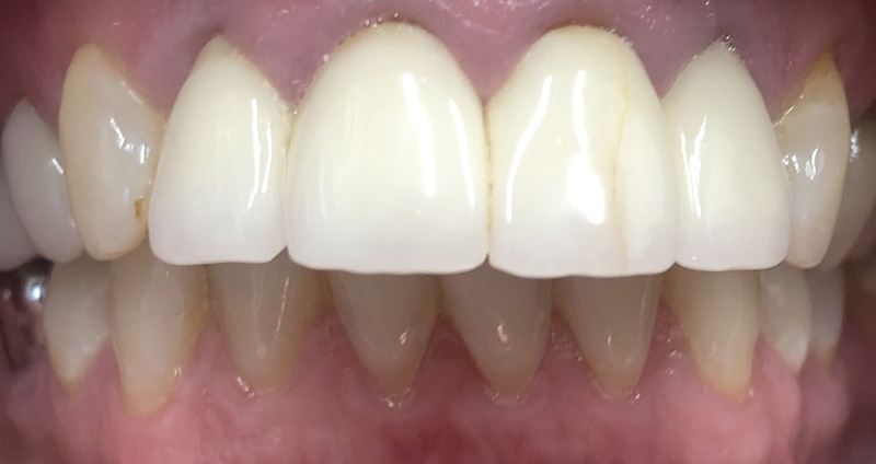 Before Image