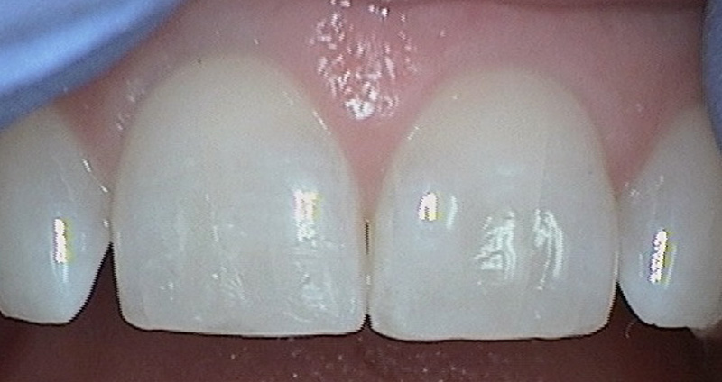 After Image
