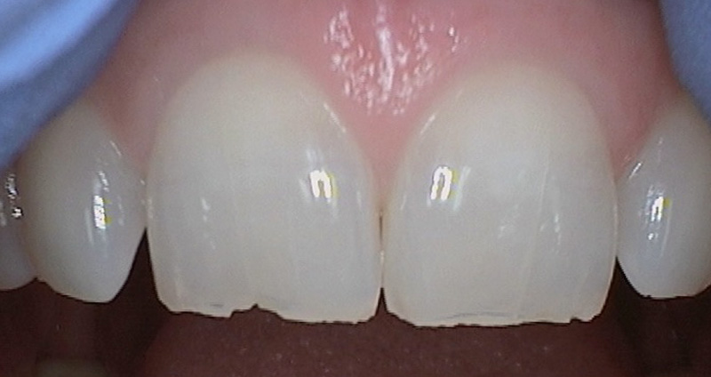 Before Image