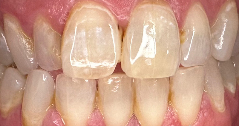 Before Image