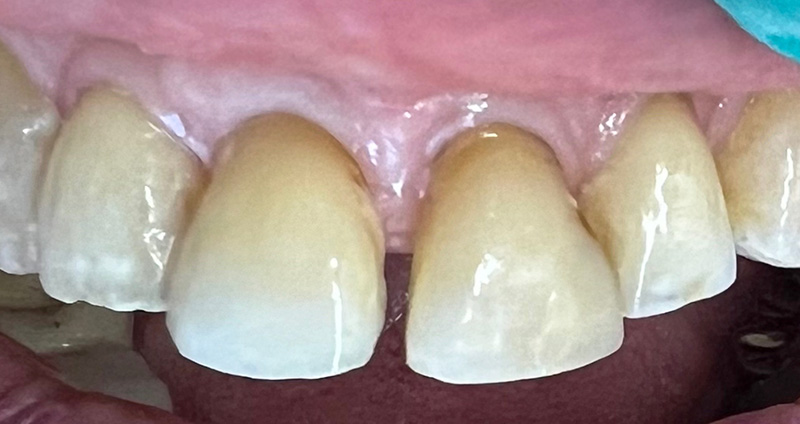 After Image