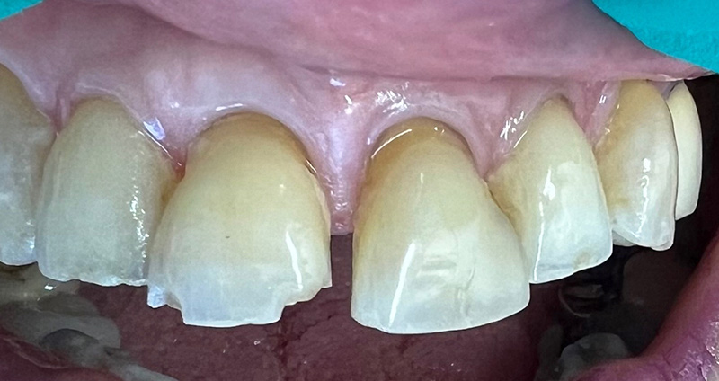 Before Image