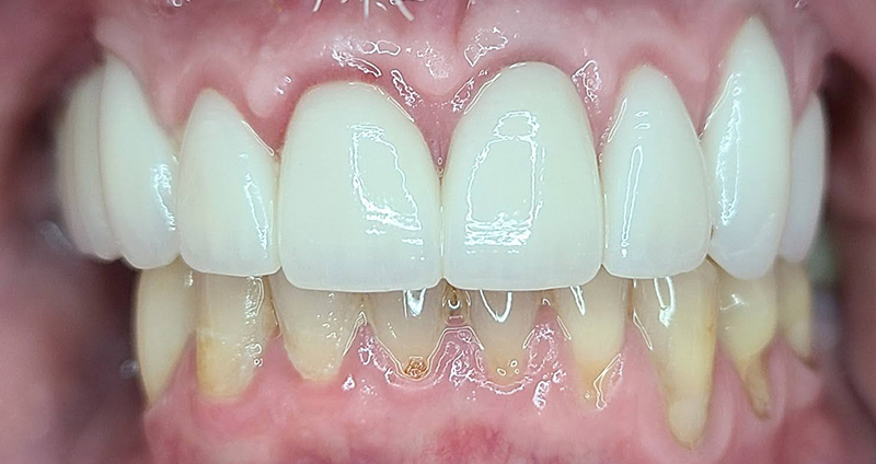 After Image