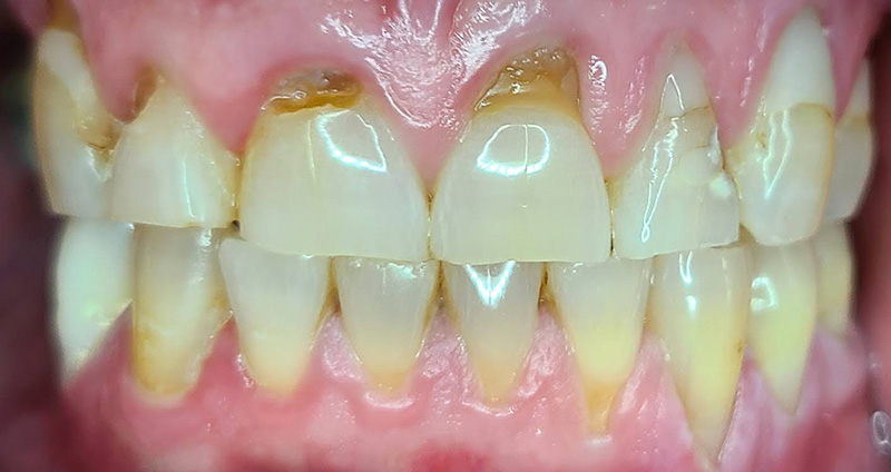 Before Image