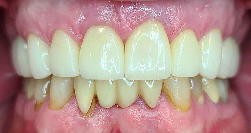 After Image