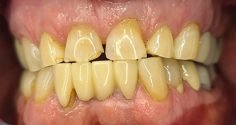 Before Image