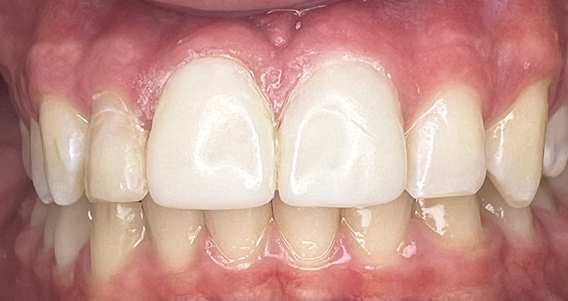 After Image