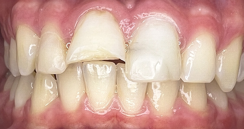 Before Image