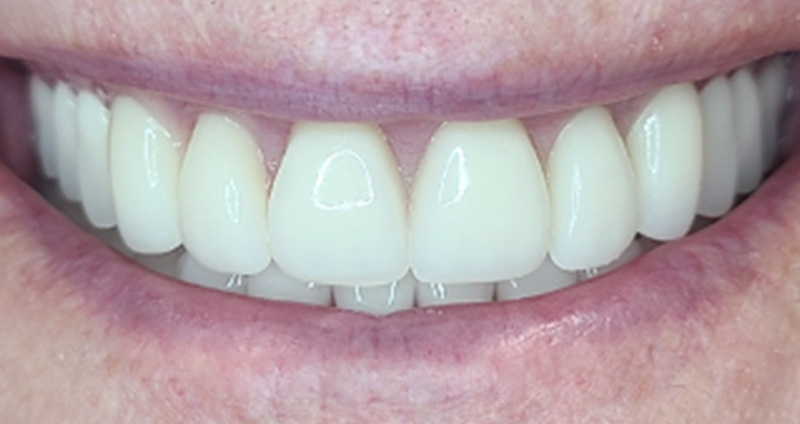 After Image