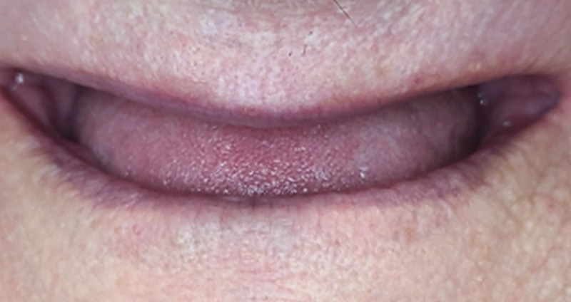 Before Image