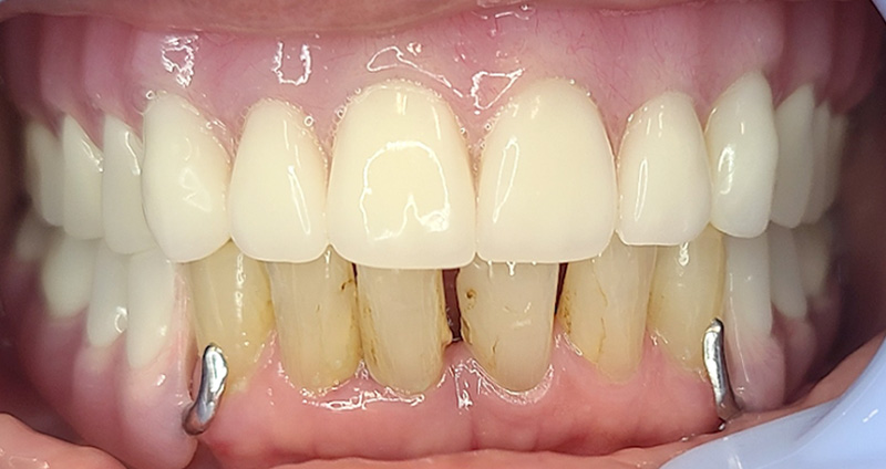 After Image
