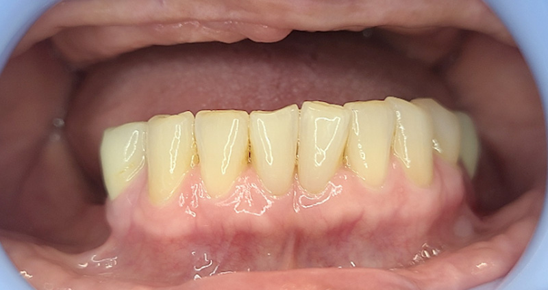 Before Image