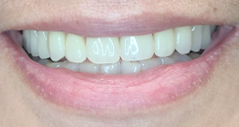 After Image