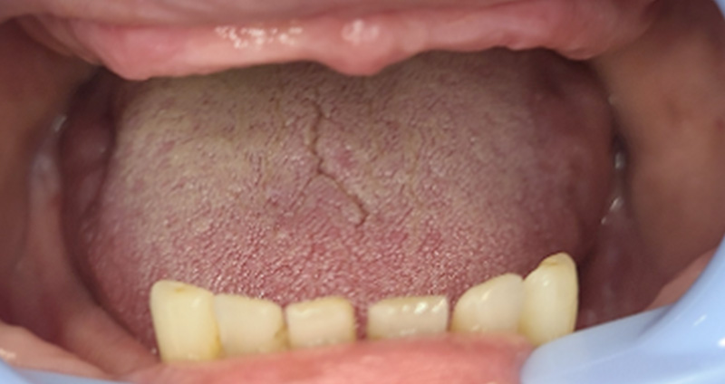 Before Image